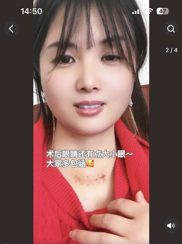 千万粉丝网红自曝患癌！网友却说：这不算病？福建医生提醒