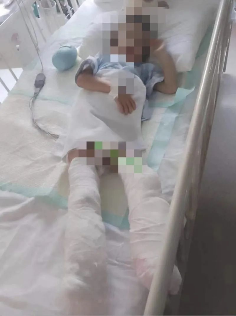 5岁男童遭生母虐待致截肢案，一审宣判！